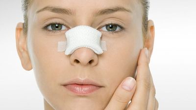 كيف تكون العناية بعد عملية تجميل الأنف؟