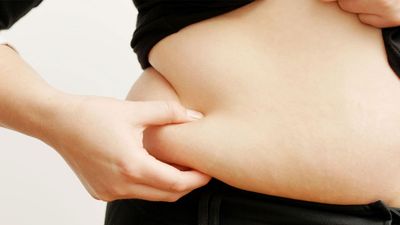 What is the therapeutic use of liposuction?