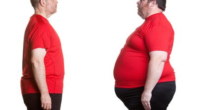 What is Liposuction?